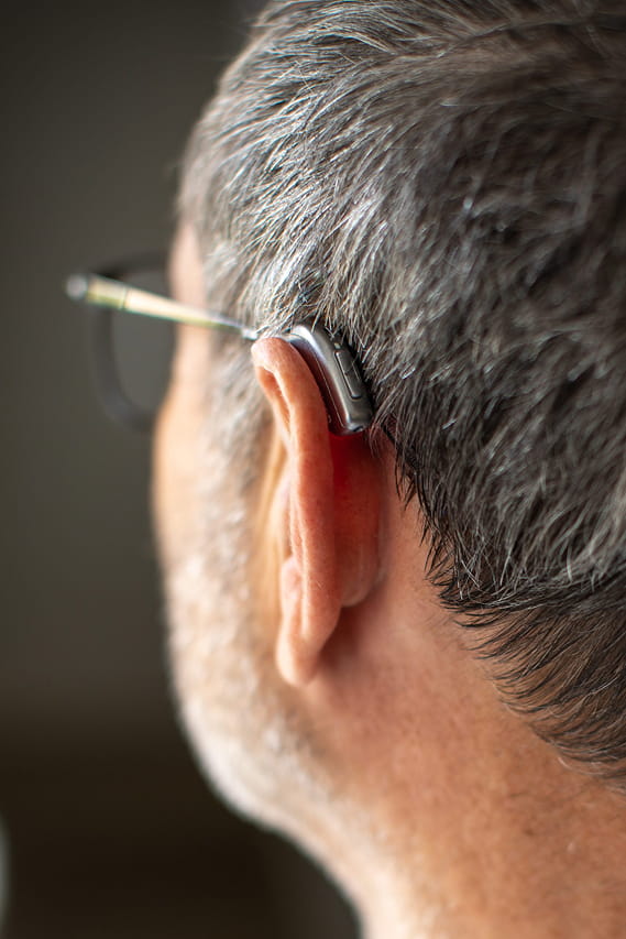 Hearing Aids